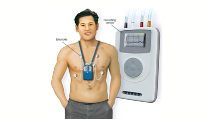 24 Hrs Holter Monitoring