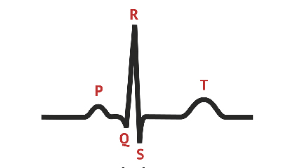 ECG